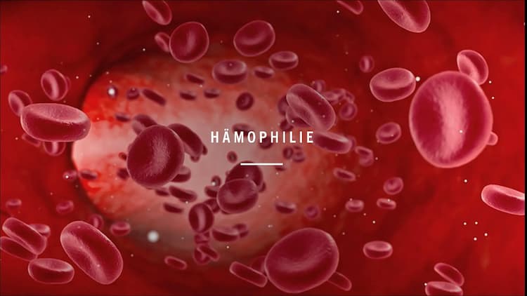 Know Hämophilie thumbnail
