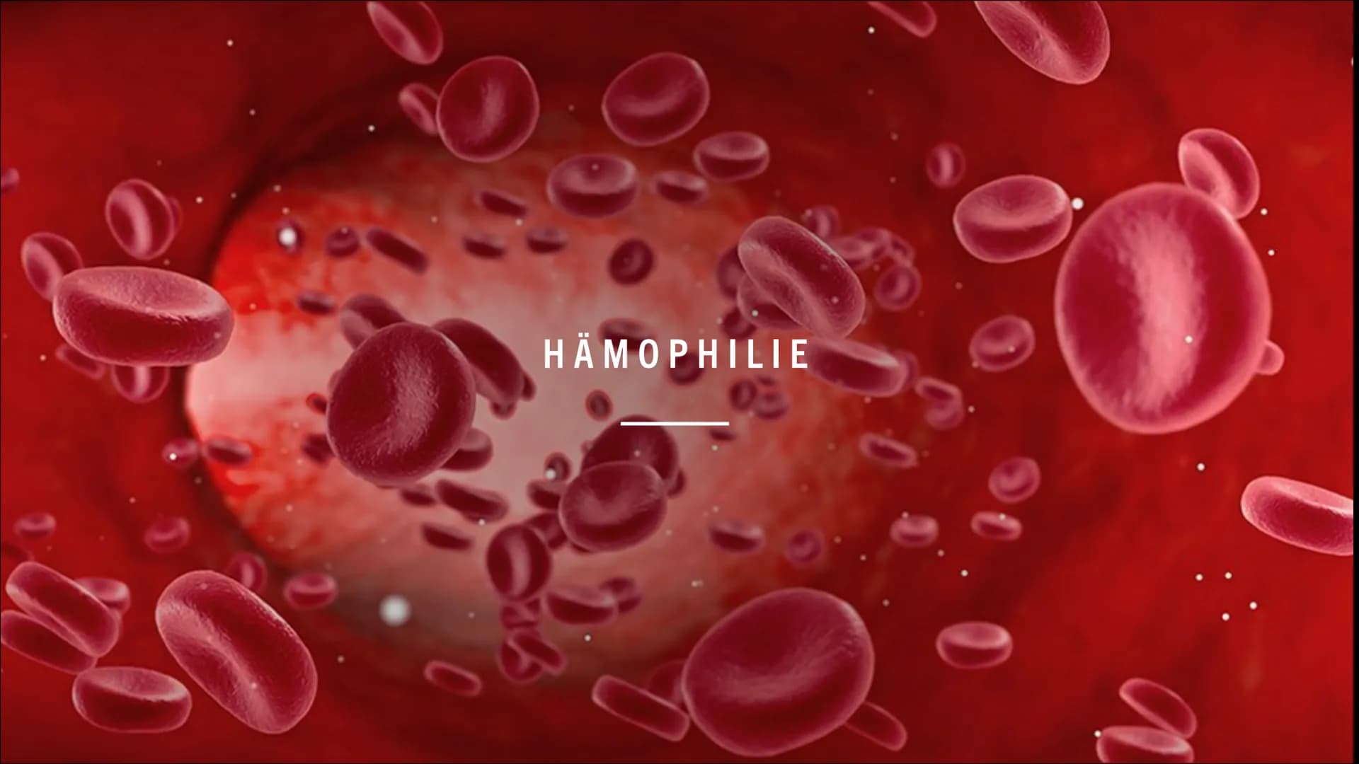 09
99
HÄMOPHILIE
FO
0.0
0
a
0 INHALT:
Was ist Hämophilie ?
Symptome
Formen der Hämophilie
Vererbung der Bluterkrankheit
Behandlung
Quellen W