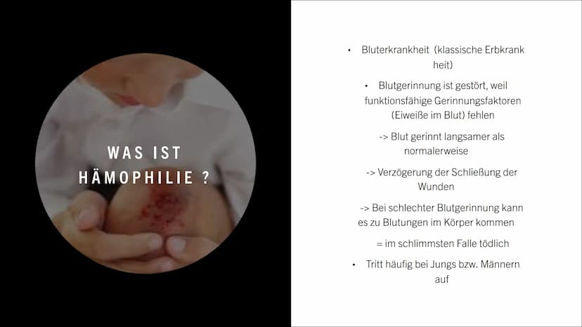 09
99
HÄMOPHILIE
FO
0.0
0
a
0 INHALT:
Was ist Hämophilie ?
Symptome
Formen der Hämophilie
Vererbung der Bluterkrankheit
Behandlung
Quellen W