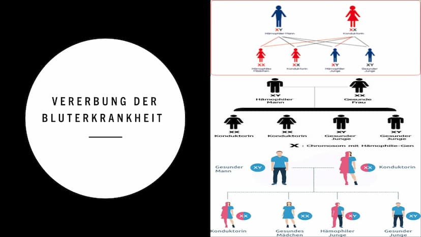 09
99
HÄMOPHILIE
FO
0.0
0
a
0 INHALT:
Was ist Hämophilie ?
Symptome
Formen der Hämophilie
Vererbung der Bluterkrankheit
Behandlung
Quellen W