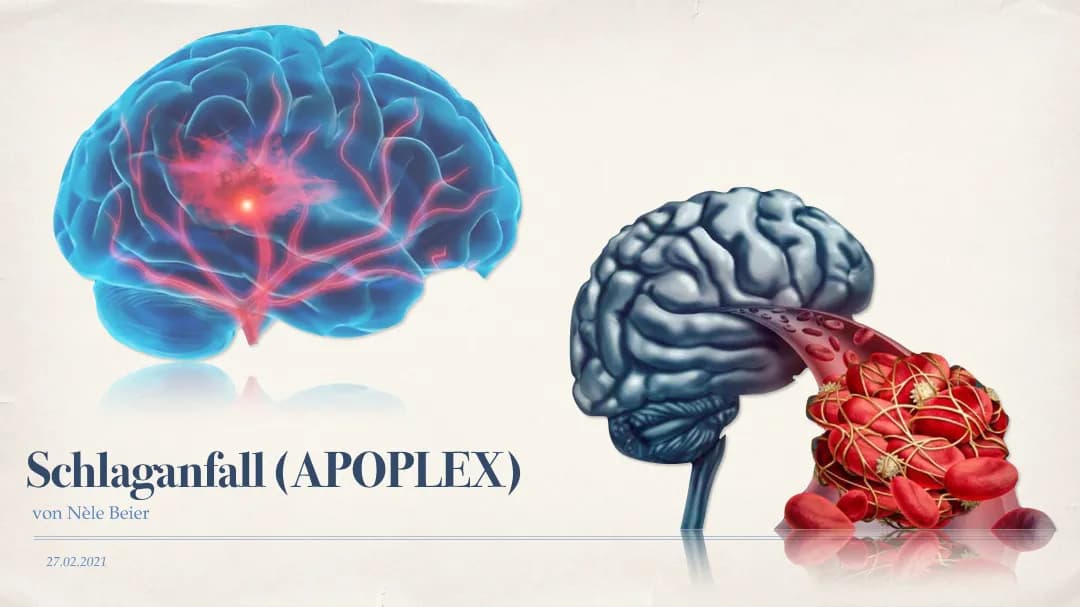 Alles über Schlaganfall: Symptome, Ursachen und Therapien