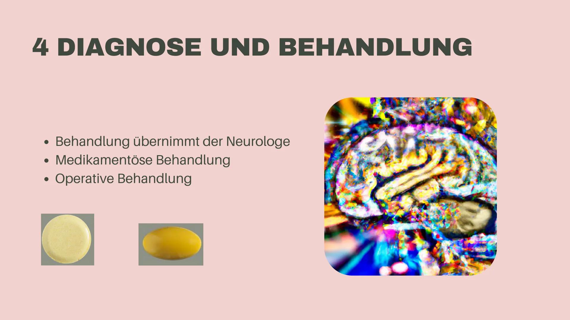 AMELIE MÖLLER
WENN DAS GEHIRN AUS
DEM TAKT GERÄT
Epilepsie GLIEDERUNG
01
02
03
04
Was ist Epilepsie?
Formen der Epilepsie
Ursachen
Diagnose 