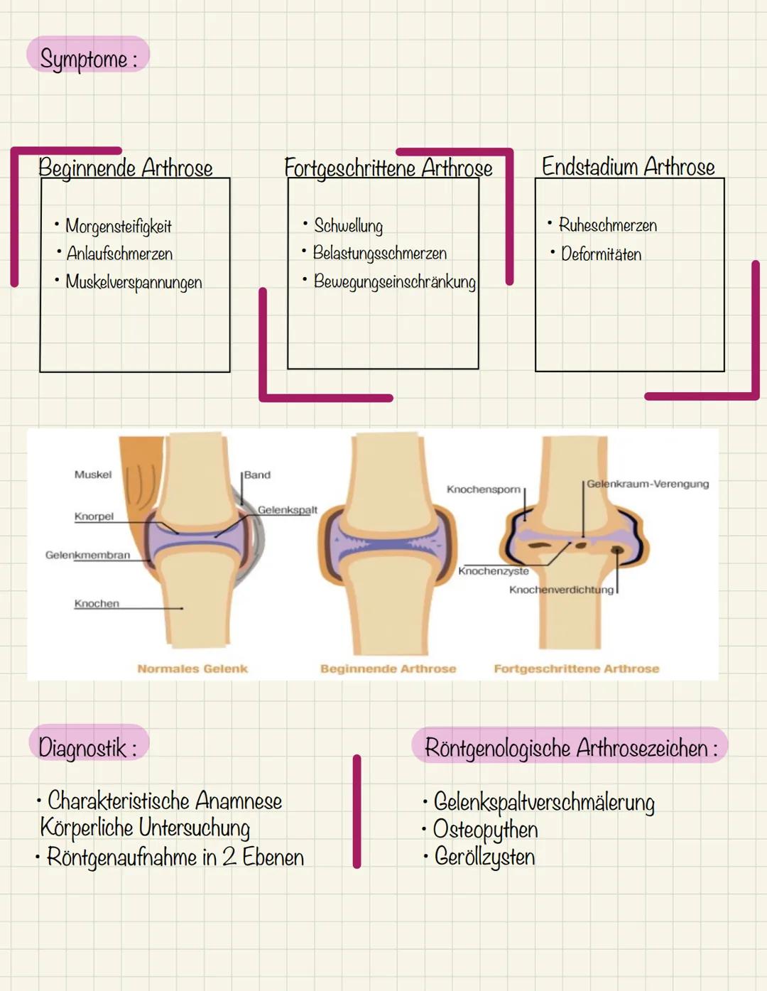 Definition:
●
• Schmerzhafte degenerative
.
• Veränderung des Gelenkknorpels mit sekundäre Knochenläsion
• Entzündlich bedingter Schrumpfung