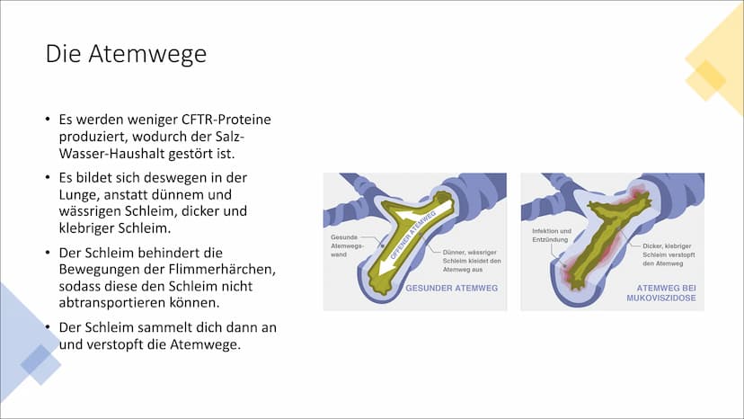Mukoviszidose
Von Theodora ●
●
●
●
●
●
●
●
●
Inhaltsverzeichnis
Was ist Mukoviszidose?
Welche Organe sind betroffen?
Wie wird die Mukoviszid