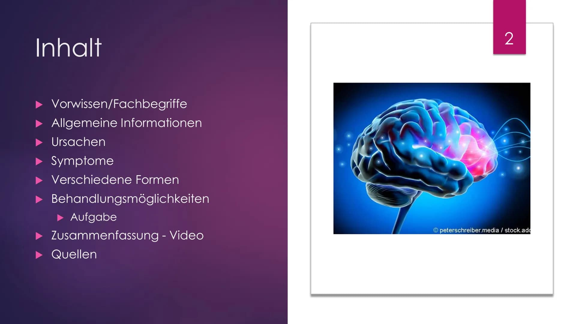 Parkinson
Eine Präsentation Von Julia Schmidtmeier
Erstellt Am 27.01.2021
Bio LK, Q2
hot
Bild: https://www.fitbook.de/health/fruehe-parkinso