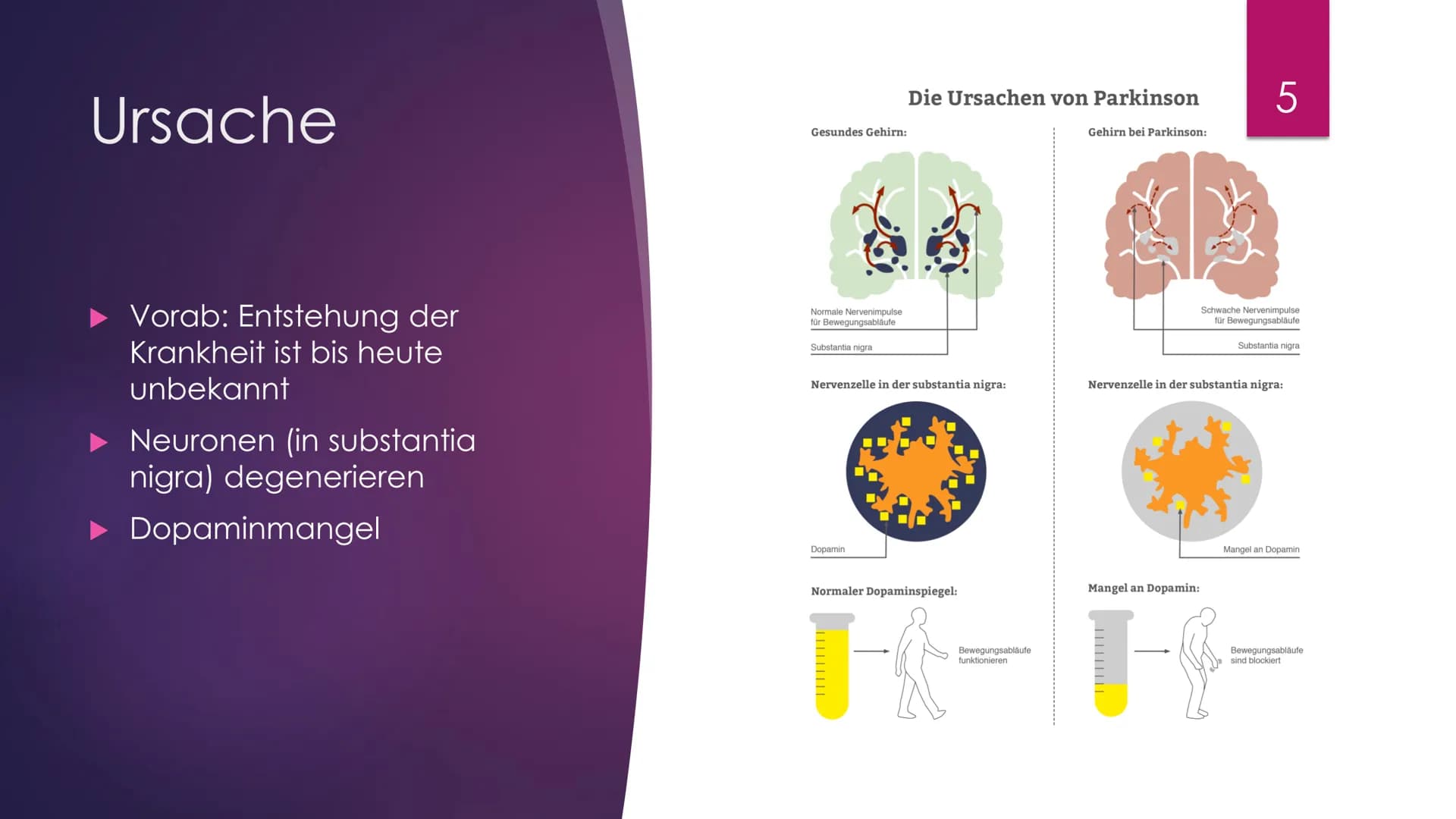 Parkinson
Eine Präsentation Von Julia Schmidtmeier
Erstellt Am 27.01.2021
Bio LK, Q2
hot
Bild: https://www.fitbook.de/health/fruehe-parkinso