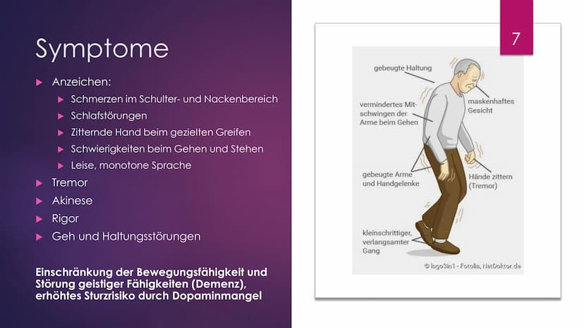 Parkinson
Eine Präsentation Von Julia Schmidtmeier
Erstellt Am 27.01.2021
Bio LK, Q2
hot
Bild: https://www.fitbook.de/health/fruehe-parkinso