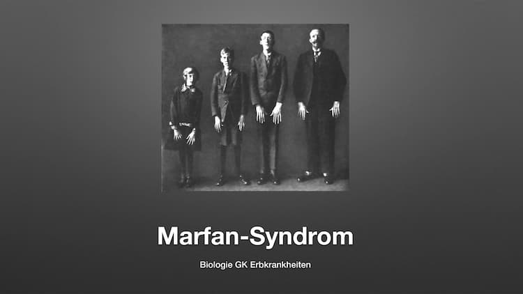 Know Marfan-Syndrom thumbnail