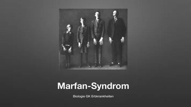 Know Marfan-Syndrom thumbnail