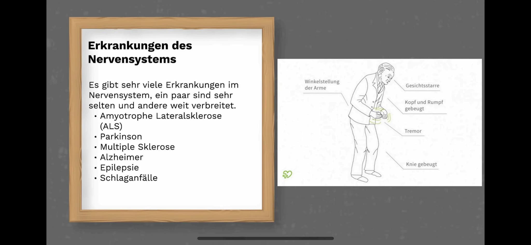 Das Nervensystem
By:
Abdurahman El-Dassouki
Annika Hagemann
Maida Huskic Das Menschliche Nervensystem
Durchquert den ganzen Körper
und Steue