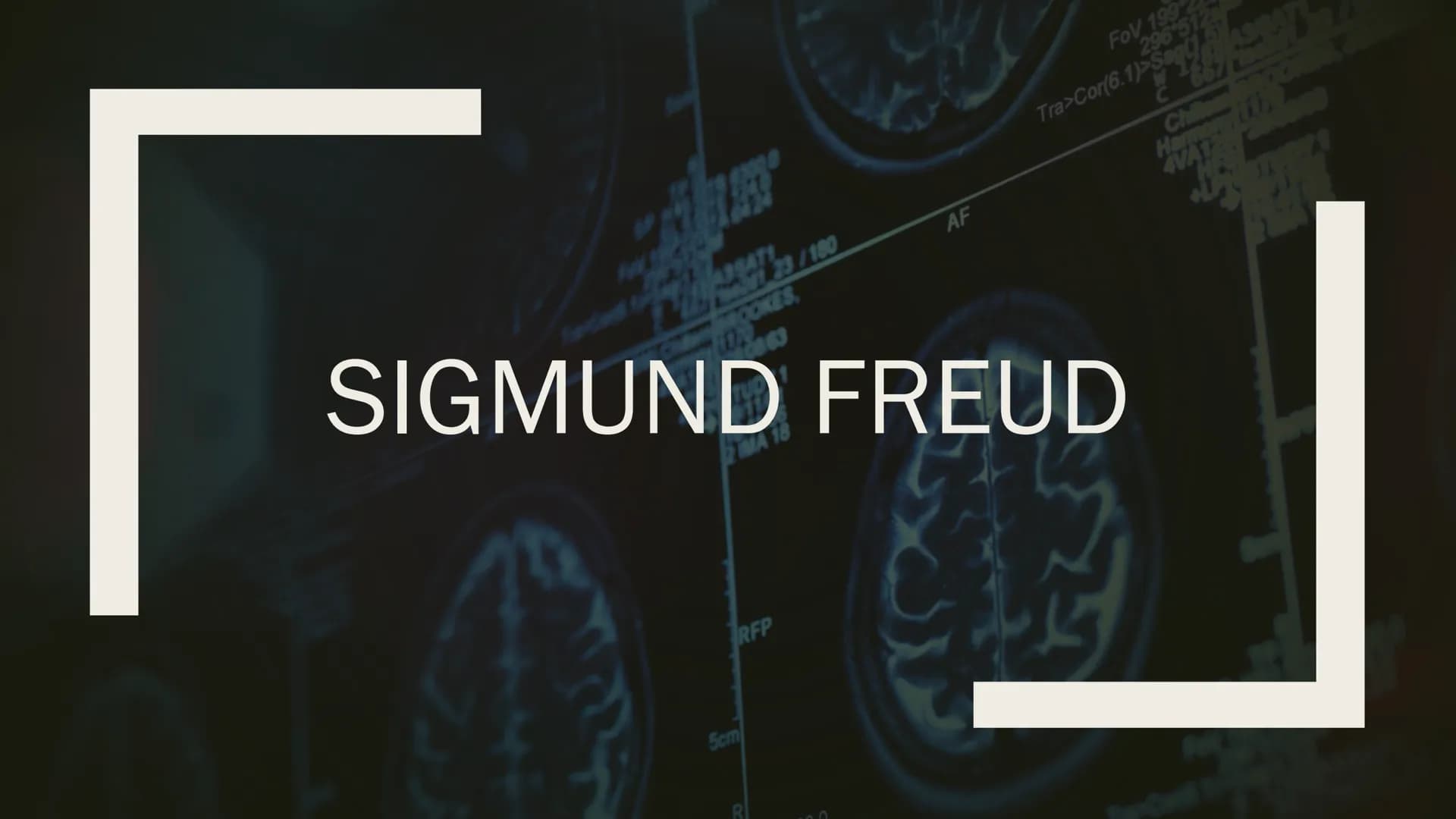 RFP
SIGMUND FREUD
5cm
AF
R
FOV 199
296 512
Tra>Cor(6.1)>Sag
Chile
AVAT
T Wer war Sigmund
Freud?
■ Mediziner
■ Begründer der Psychoanalyse
■ 