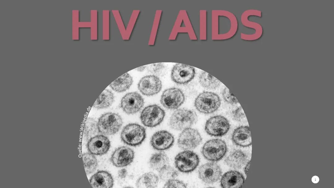 HIV , AIDS
