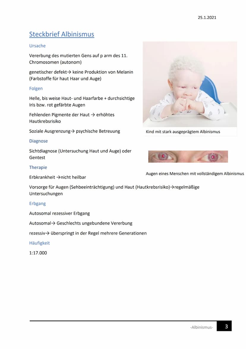 Albinismus
1. Was ist Albinismus
2. Ursache der Entstehung
3. Folgen
4. Erbgang und Häufigkeit
5. Diagnose
6. Therapie
7 Einschränkungen
1. 