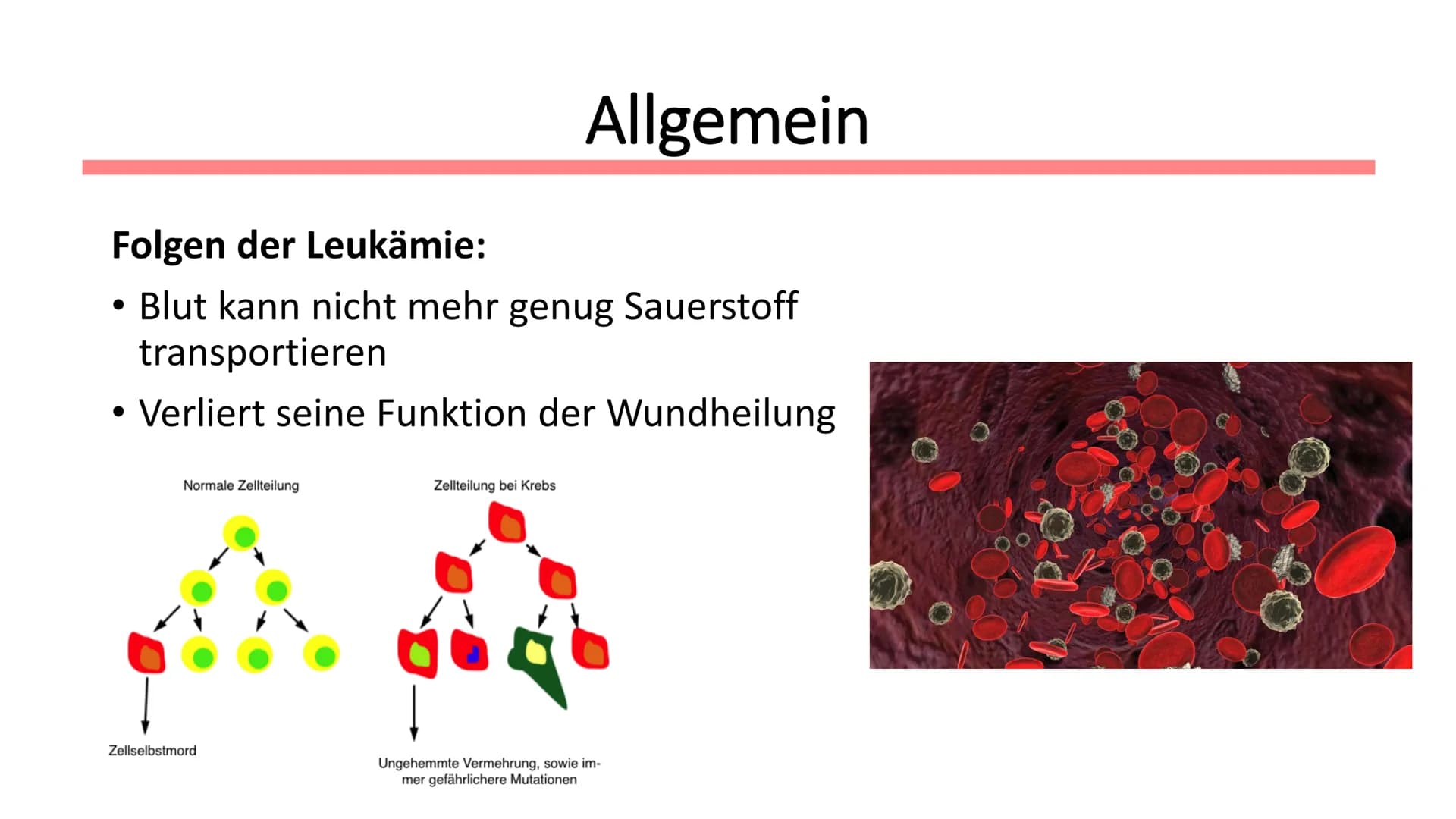 Leukämie
Biologie / Klasse / Name / Datum ●
Symptome
• Diagnostik
Therapie
Allgemein
Wen betrifft es?
●
Gliederung
Autologe Stammzelltherapi