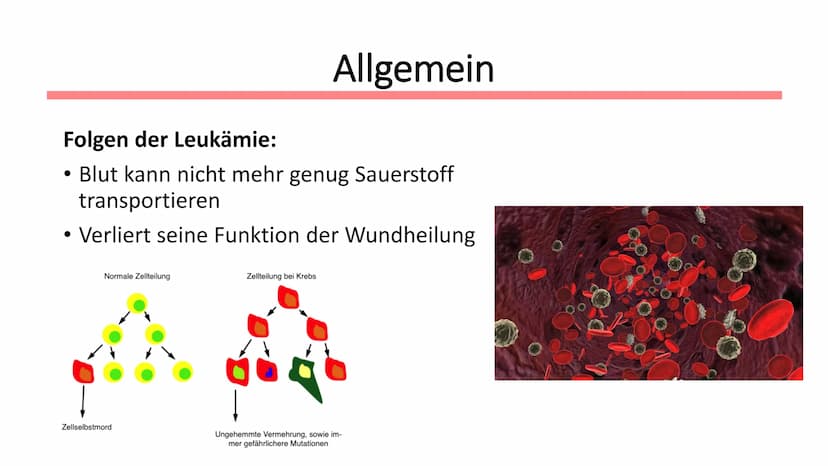 Leukämie
Biologie / Klasse / Name / Datum ●
Symptome
• Diagnostik
Therapie
Allgemein
Wen betrifft es?
●
Gliederung
Autologe Stammzelltherapi