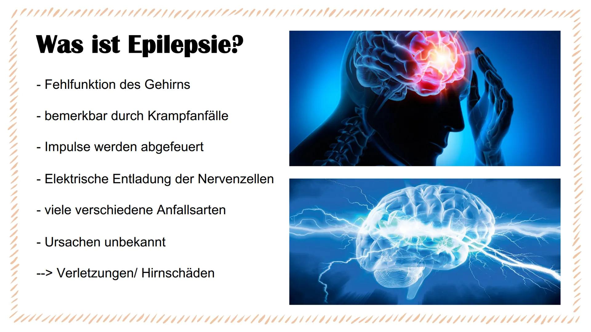 Aufbau des Gehirns & Epilepsie
Eine Präsentation von Linda und Isabel Was kommt in unserer PowerPoint vor?
Aufbau des Gehirns
888
Die Lappen