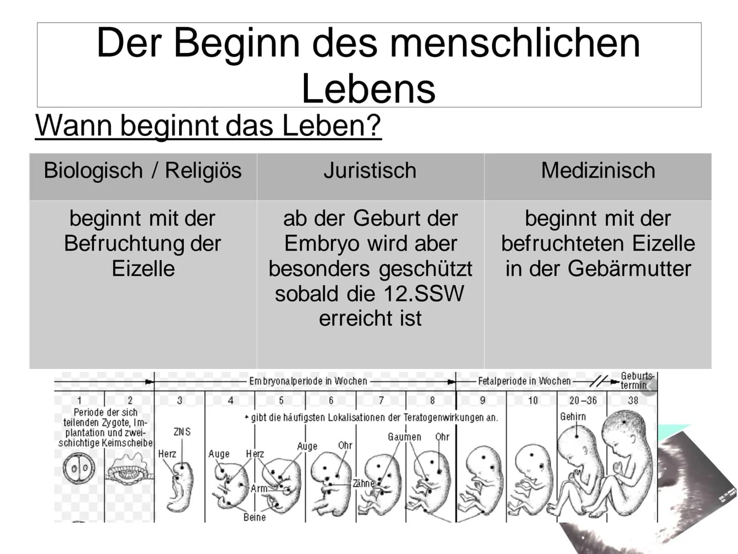 Schwangerschaftsabbruch
T
BERATUNGSPFLICHT
MULTIERZY
VERURTEILUNG
BELL
GYNÄKOLOGEN
ZEITDRUCK Schwangerschaftsabbruch
Gliederung:
• Allgemein