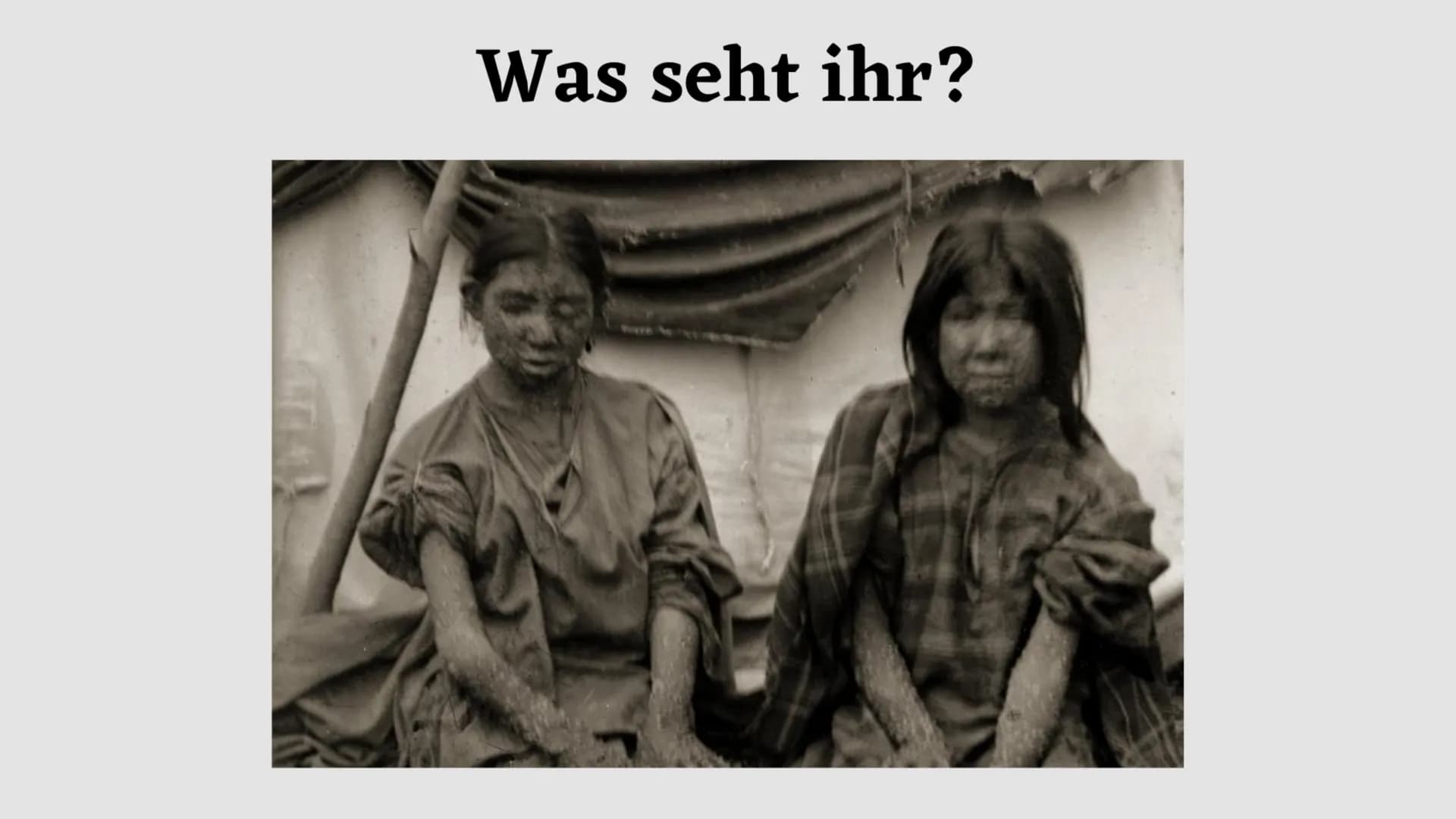 Was seht ihr? Pockenschutzimpfung 1874
Handout
Pocken Allgemein:
- Lebensgefährlicher Virus
- Infizierte sind übersäht mit Hautbläschen
Zust