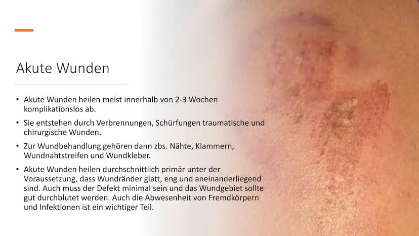 alio
Einmal
Handsch
Handschuhe
alio Einmal
Bei primär und
sekundär heilenden
Wunden einen
Verband wechseln
Handlungskompetenz D.7
Lia Serain