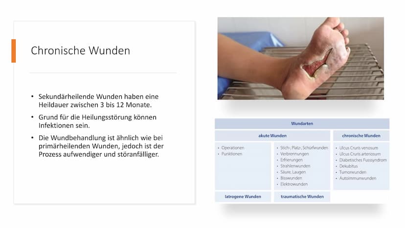 alio
Einmal
Handsch
Handschuhe
alio Einmal
Bei primär und
sekundär heilenden
Wunden einen
Verband wechseln
Handlungskompetenz D.7
Lia Serain
