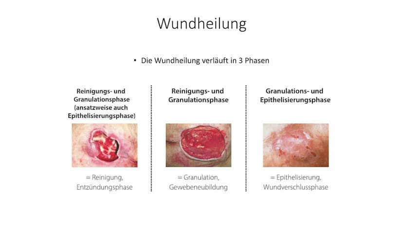 alio
Einmal
Handsch
Handschuhe
alio Einmal
Bei primär und
sekundär heilenden
Wunden einen
Verband wechseln
Handlungskompetenz D.7
Lia Serain