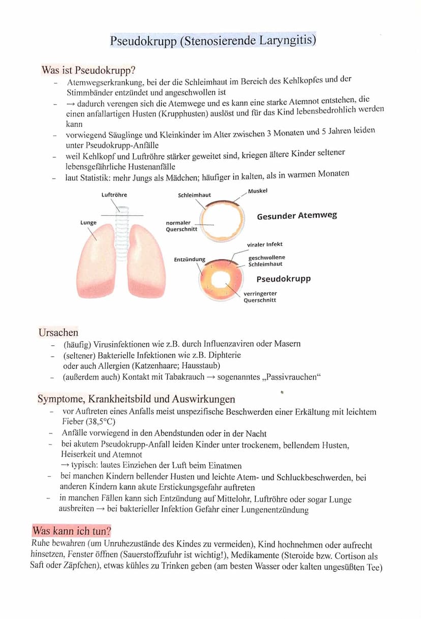 Pseudokrupp (Stenosierende Laryngitis)
Was ist Pseudokrupp?
Atemwegserkrankung, bei der die Schleimhaut im Bereich des Kehlkopfes und der
St