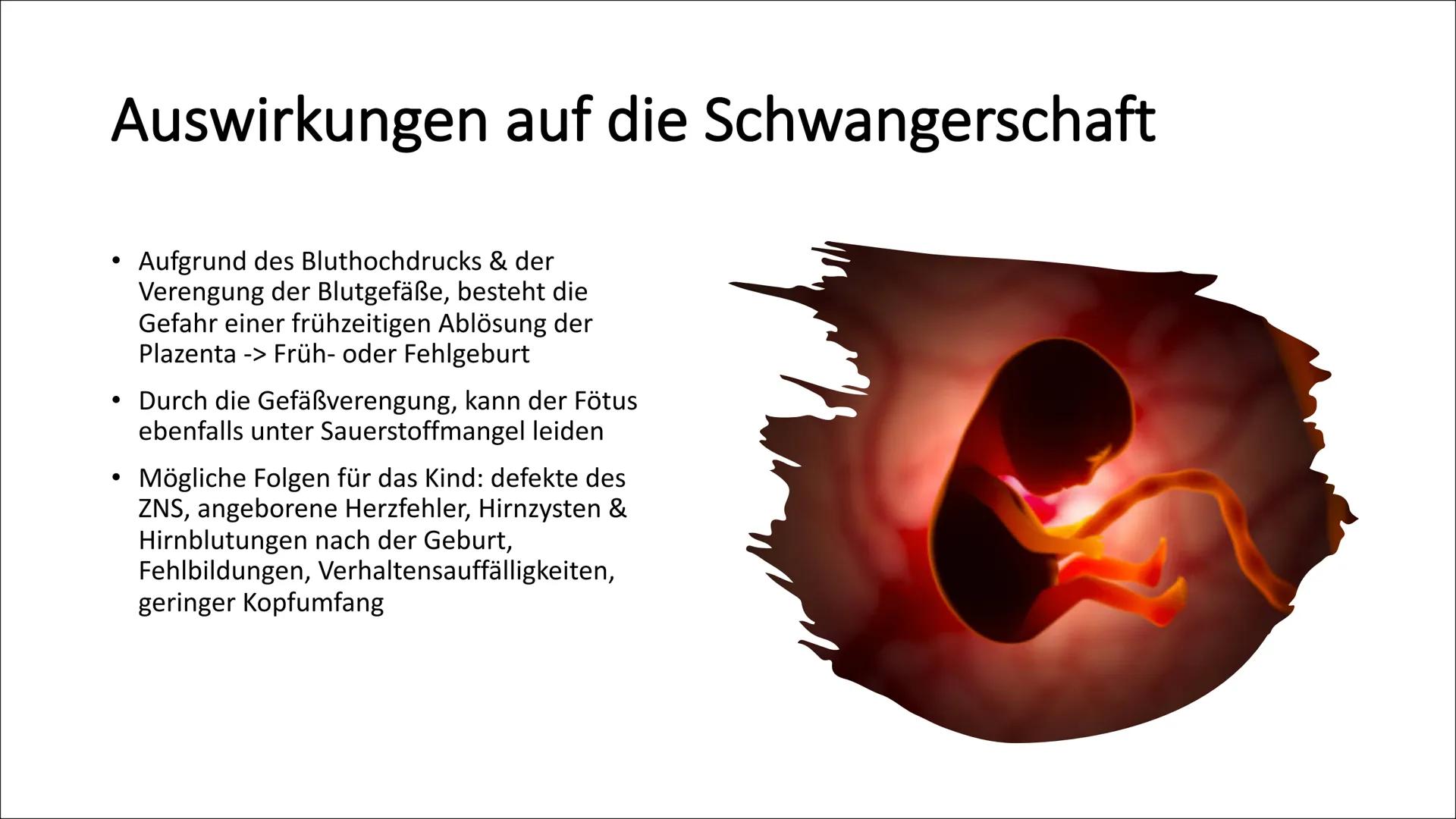Was Kokain mit
uns macht
Von Stacie Alozie criminal death
crackdrug!
cocaineit
substance enjoyment addict
gangster snorting preparation
addi