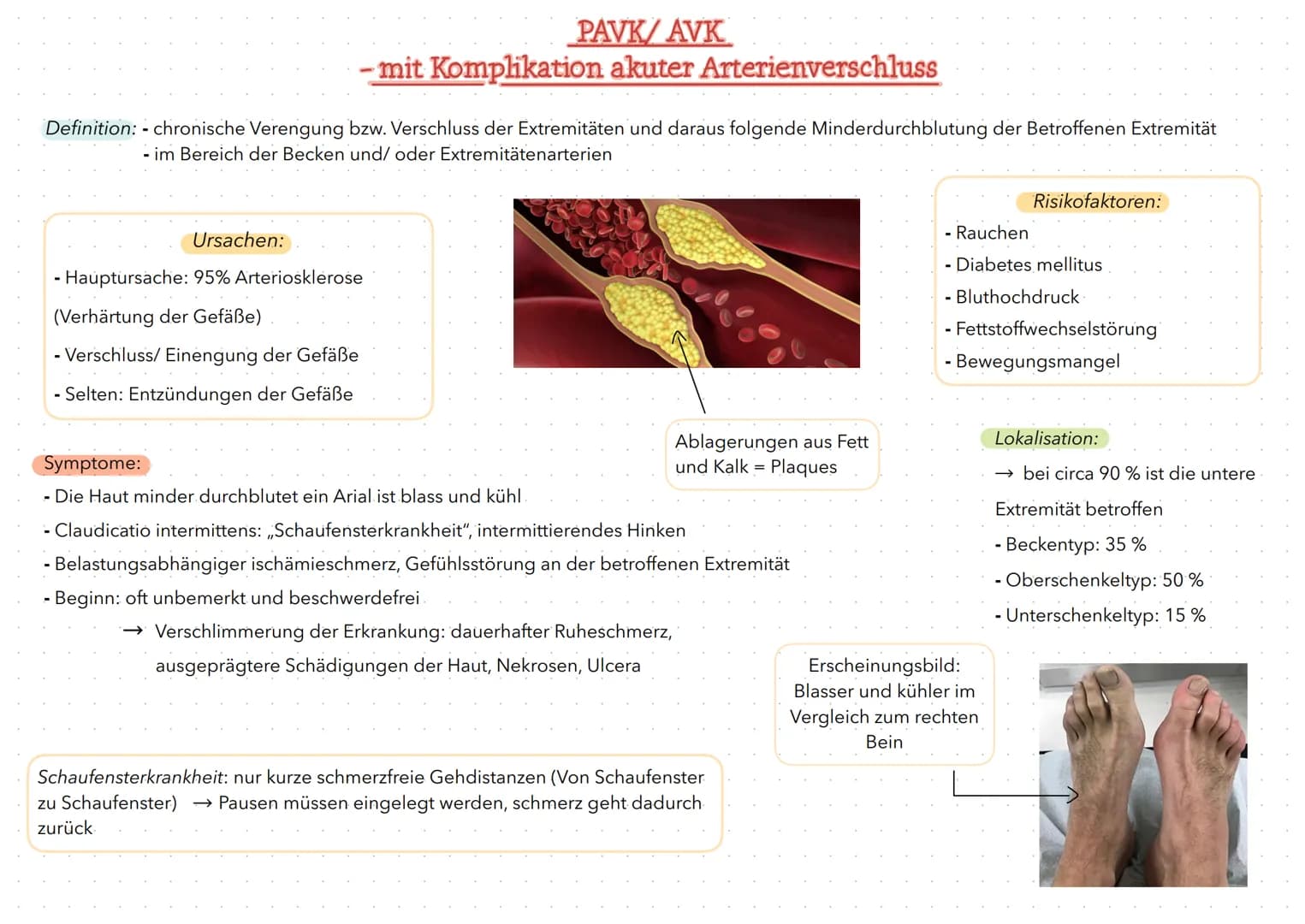 PAVK/AVK
- mit Komplikation akuter Arterienverschluss
Definition: - chronische Verengung bzw. Verschluss der Extremitäten und daraus folgend
