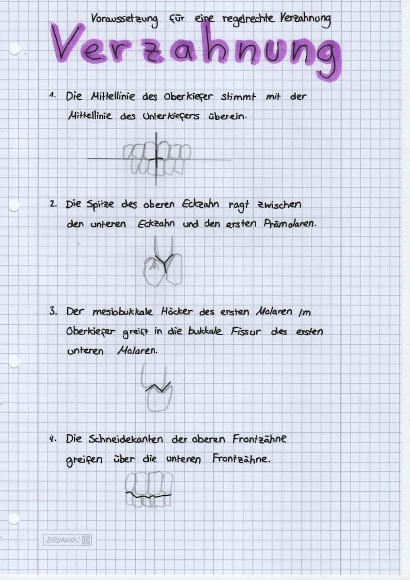 Folge mir auf:
• Instagram
● Knowunity
• TikTok
Alveole
Cervic
radix
Corona
dentis
dentis
Speicheldrüsen
3 große paarige Speicheldrüsen
zahl