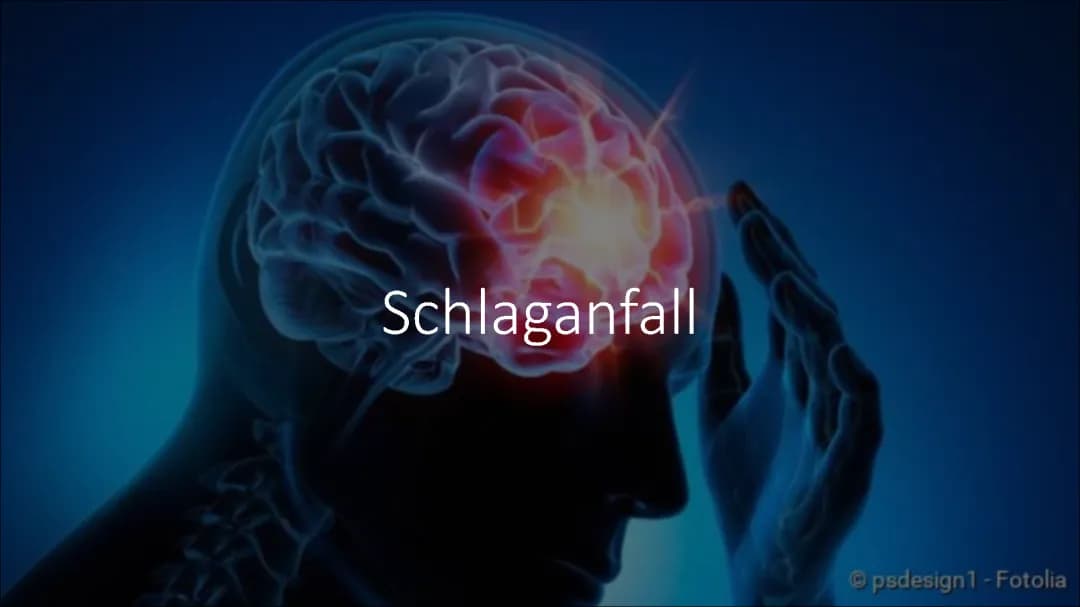 Schlaganfall 
