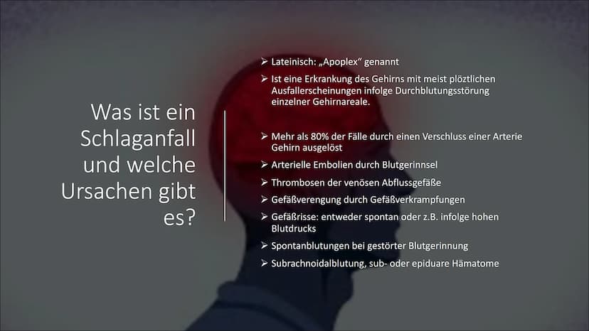 H
Schlaganfall
psdesign1 - Fotolia Was ist ein
Schlaganfall
und welche
Ursachen gibt
es?
Lateinisch: ,,Apoplex" genannt
Ist eine Erkrankung 