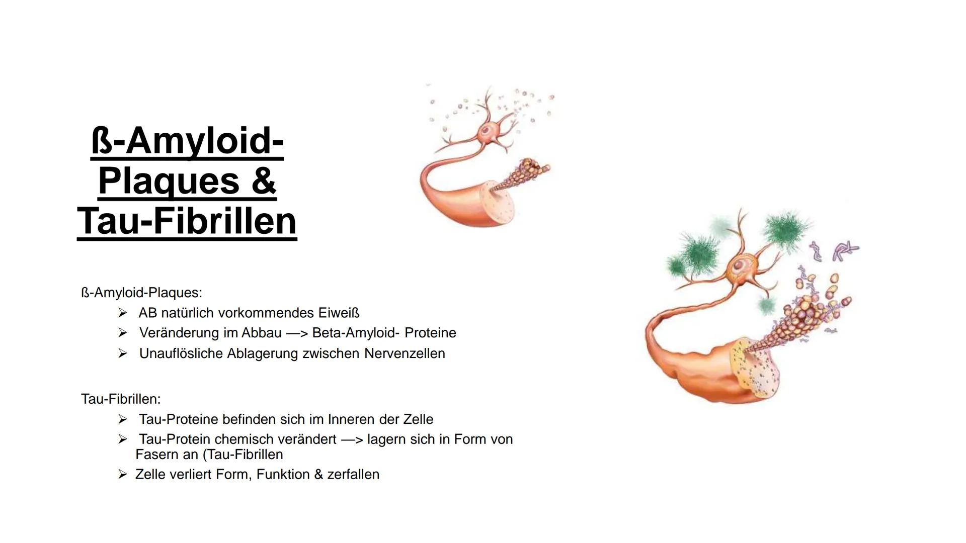 # neurodegenerative
## Erkrankungen
Alzheimer, Parkinson # Inhalts-
verzeichnis

Neurodegenerative Erkrankungen

Abbau von Nervenzellen

Alz