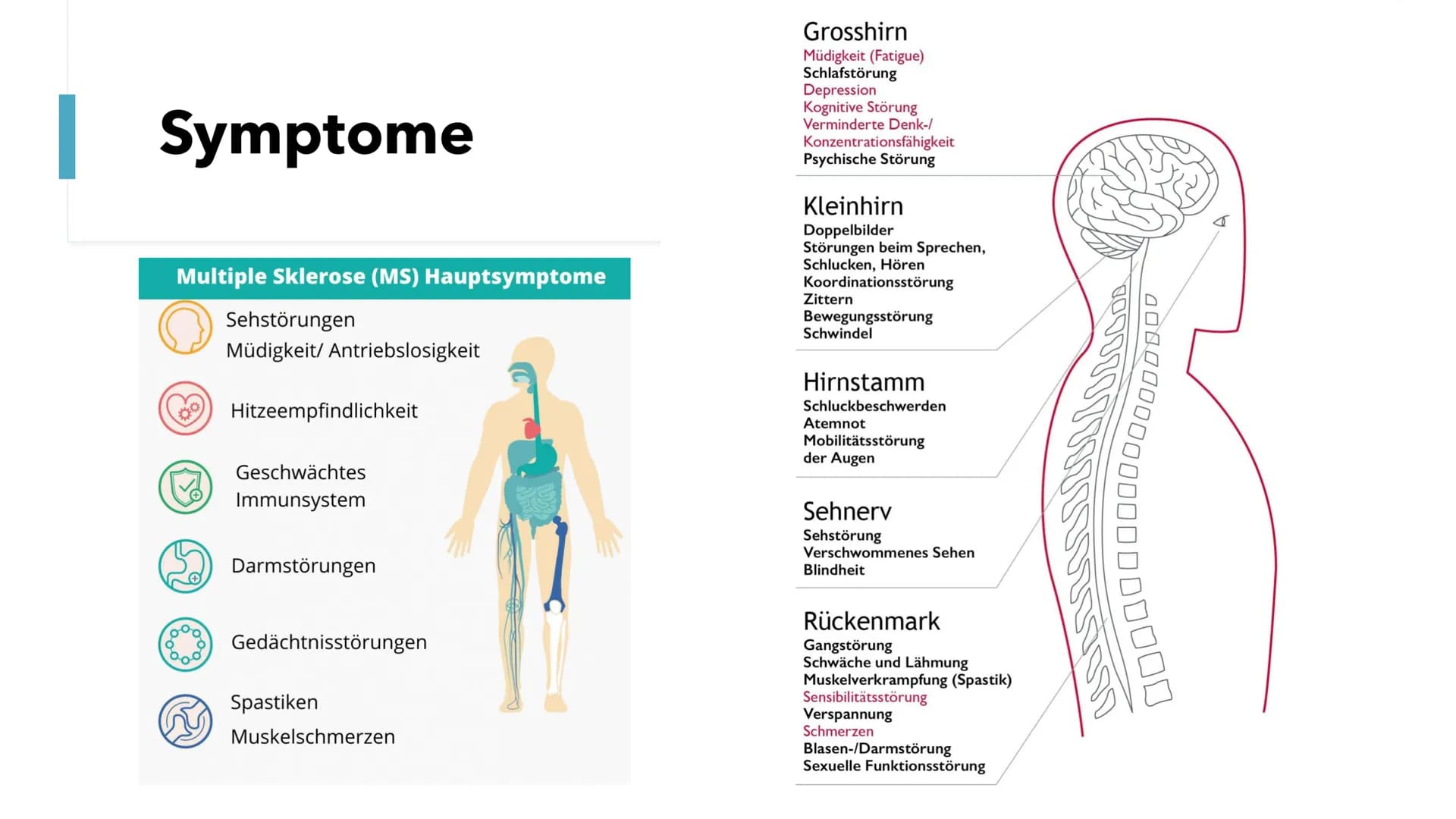 Multiple Skelrose (MS)
Die Krankheit der tausend Gesichter Gliederung
1. Allgemeine Fakten
2.
Was ist MS?
3. Was passiert bei MS?
4.
Ursache