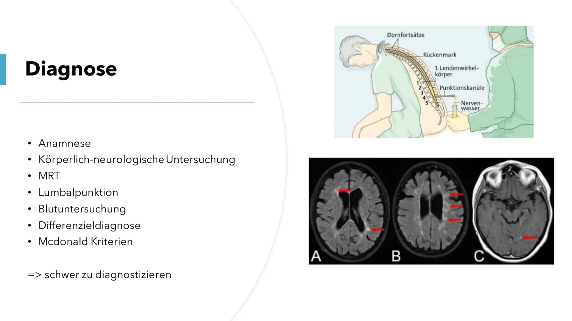 Multiple Skelrose (MS)
Die Krankheit der tausend Gesichter Gliederung
1. Allgemeine Fakten
2.
Was ist MS?
3. Was passiert bei MS?
4.
Ursache