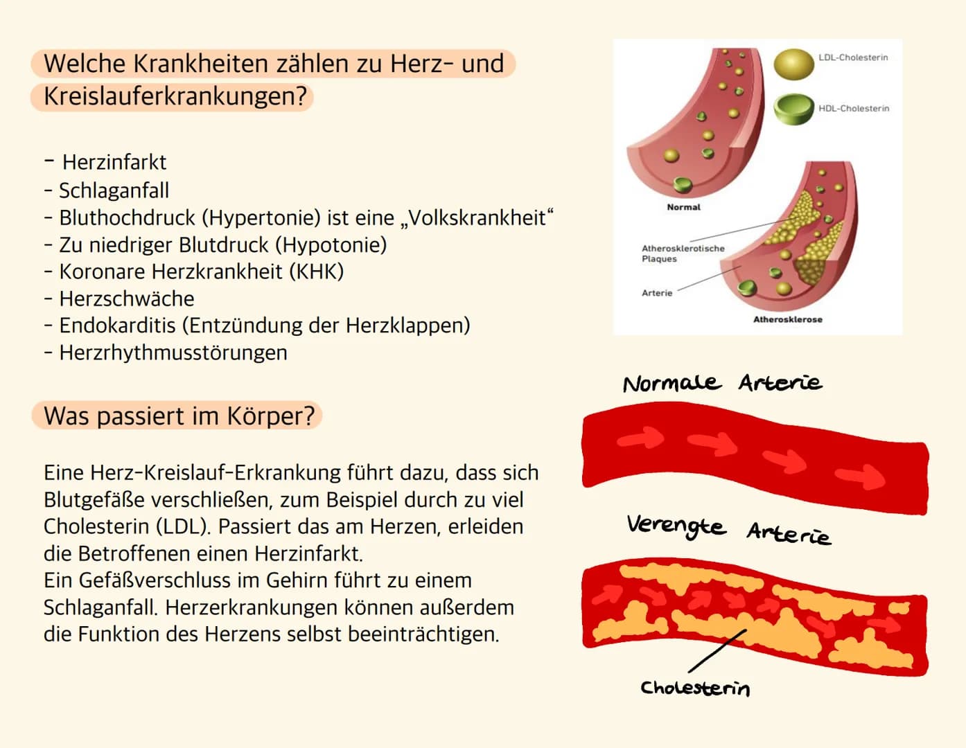 Herz-Kreislauf-
Erkrankungen Welche Krankheiten zählen zu Herz- und
Kreislauferkrankungen?
- Herzinfarkt
- Schlaganfall
- Bluthochdruck (Hyp