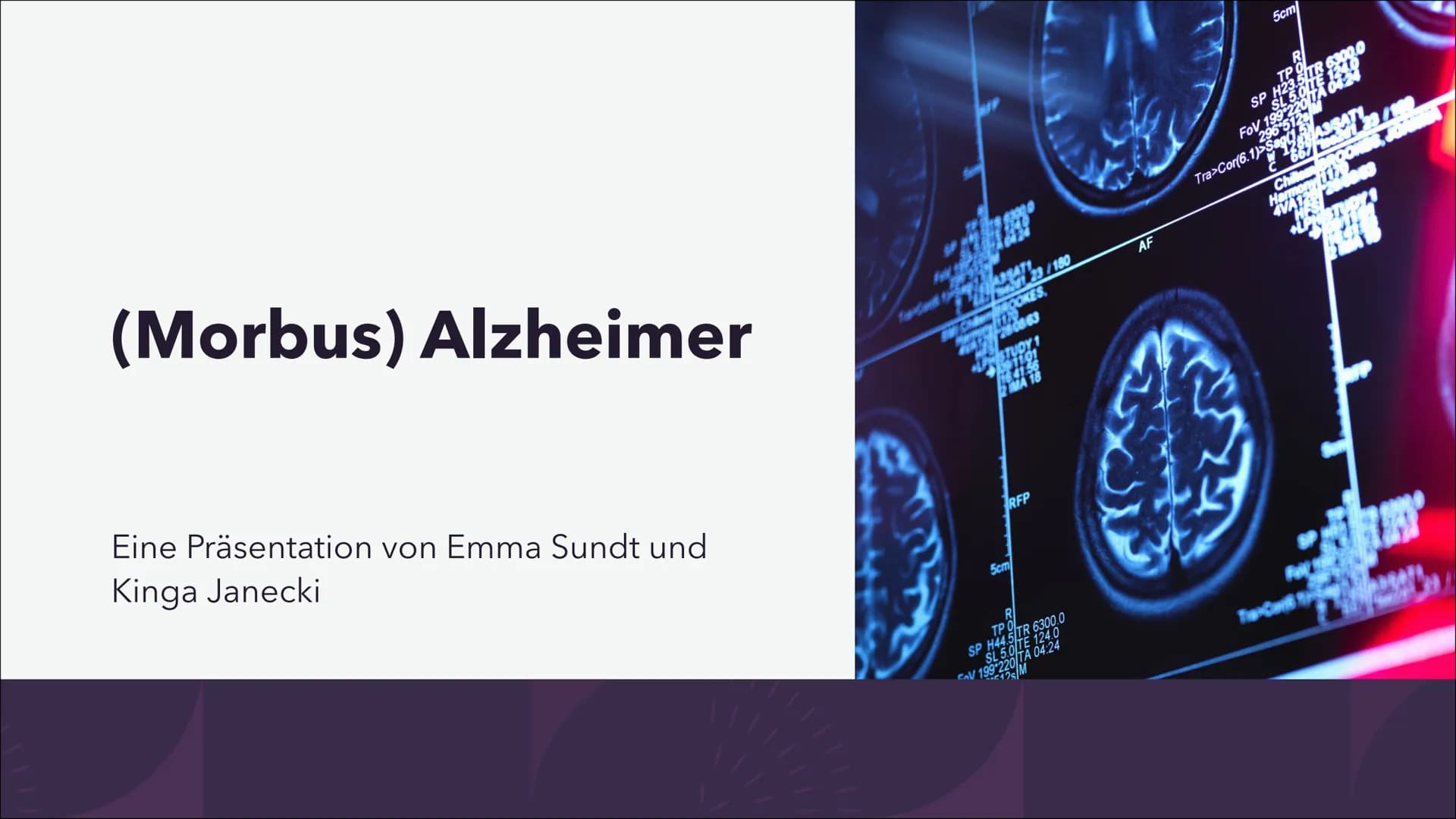 (Morbus) Alzheimer
Eine Präsentation von Emma Sundt und
Kinga Janecki
STUD
176 17
MA 18
RFP
5cm
RI
TPi
SP H44 5 TR 6300.0
SL 5.0 LTE 124.0
C