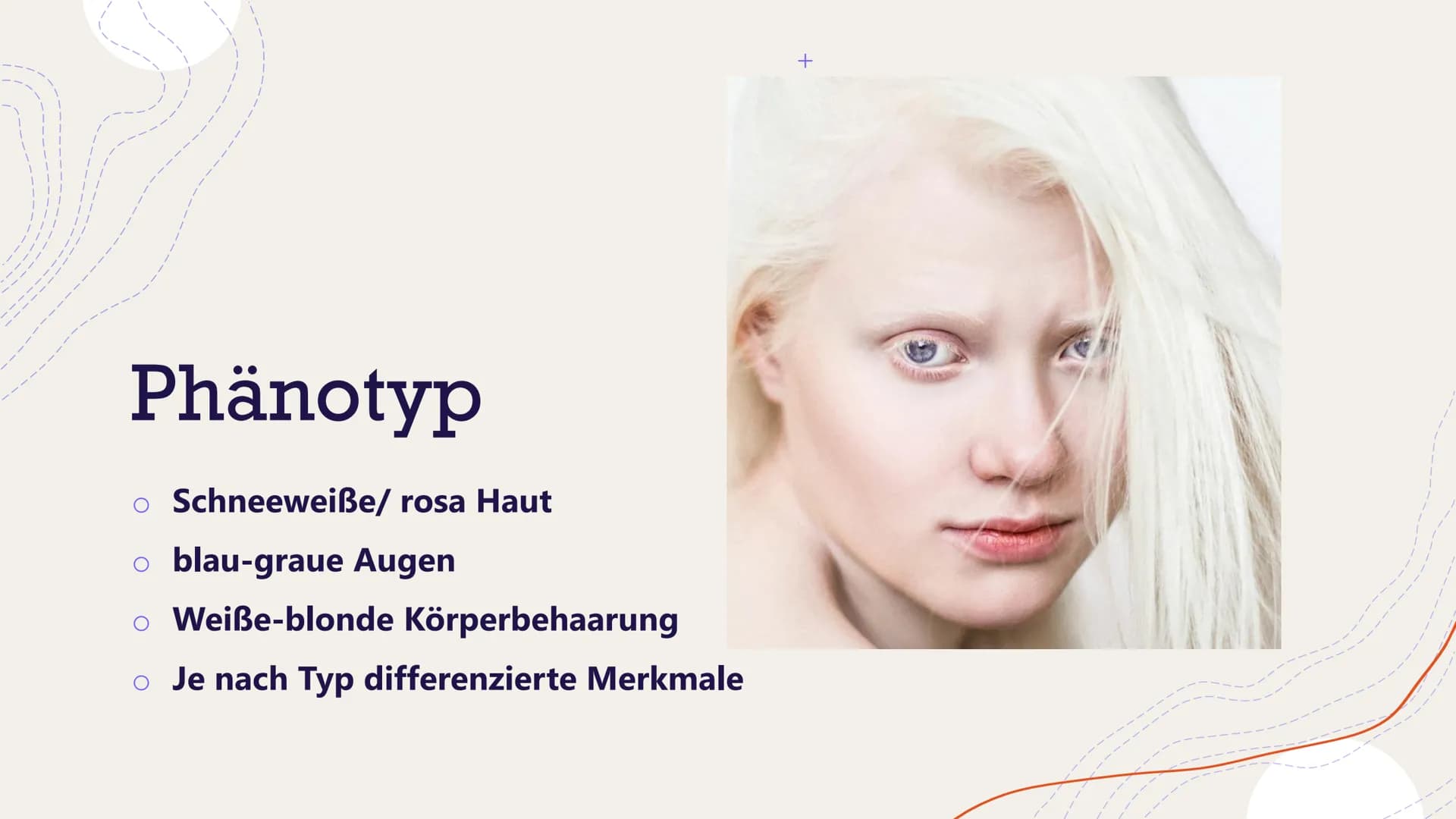 Albinismus
Von Henriette Dehnel Gliederung
Allgemeines
o Melanin
o Erbgang
o Phänotyp und Symptome
Formen des Albinismus
o Diagnose
o Therap