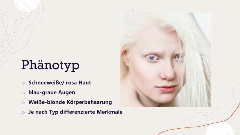 Albinismus
Von Henriette Dehnel Gliederung
Allgemeines
o Melanin
o Erbgang
o Phänotyp und Symptome
Formen des Albinismus
o Diagnose
o Therap