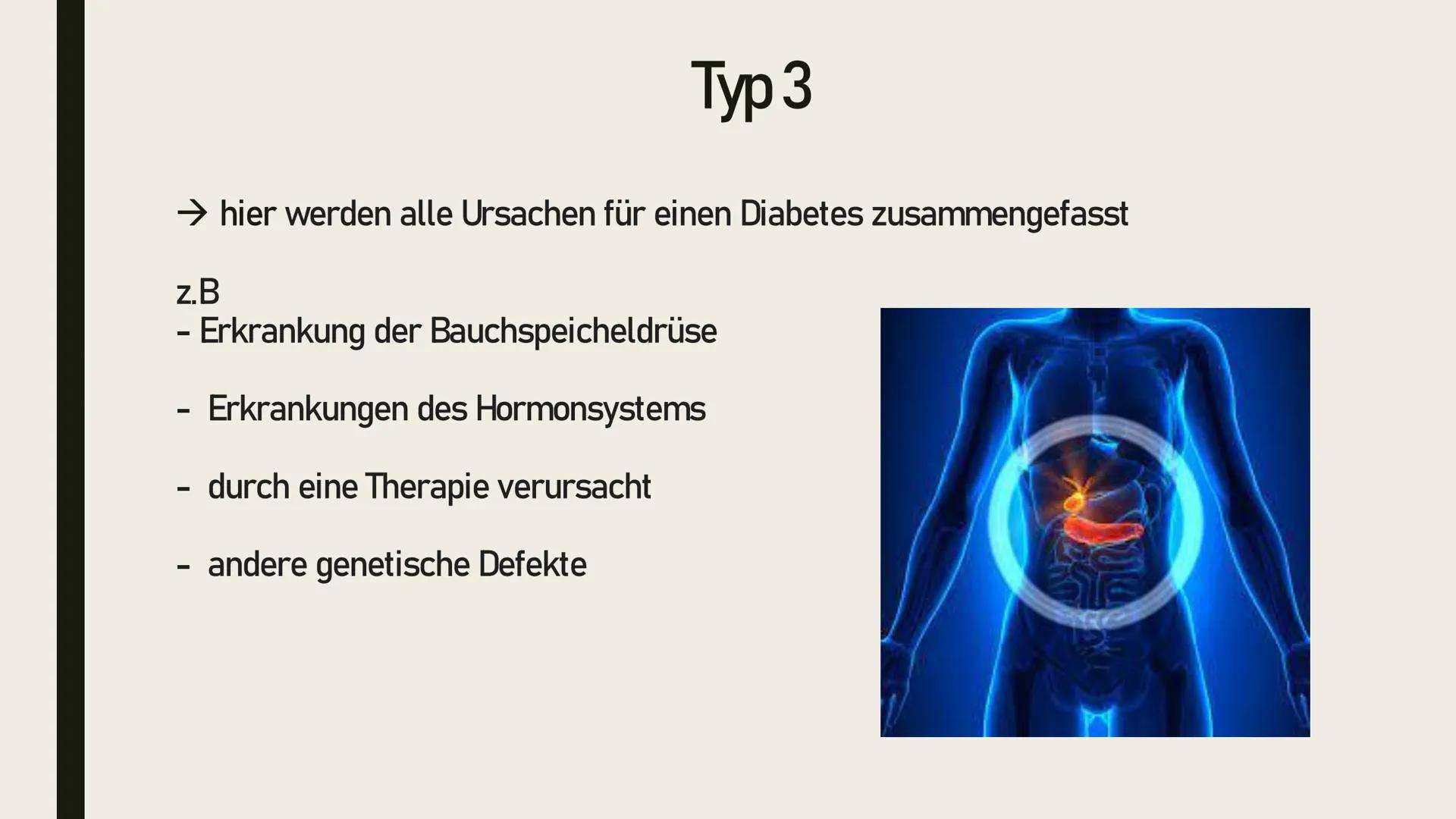 # Diabetes Mellitus # Themen

- Typische Mythen
-
Was ist Diabetes mellitus
-
- Die Unterschiede zwischen Diabetes mellitus Typ 1, 2, 3 und 
