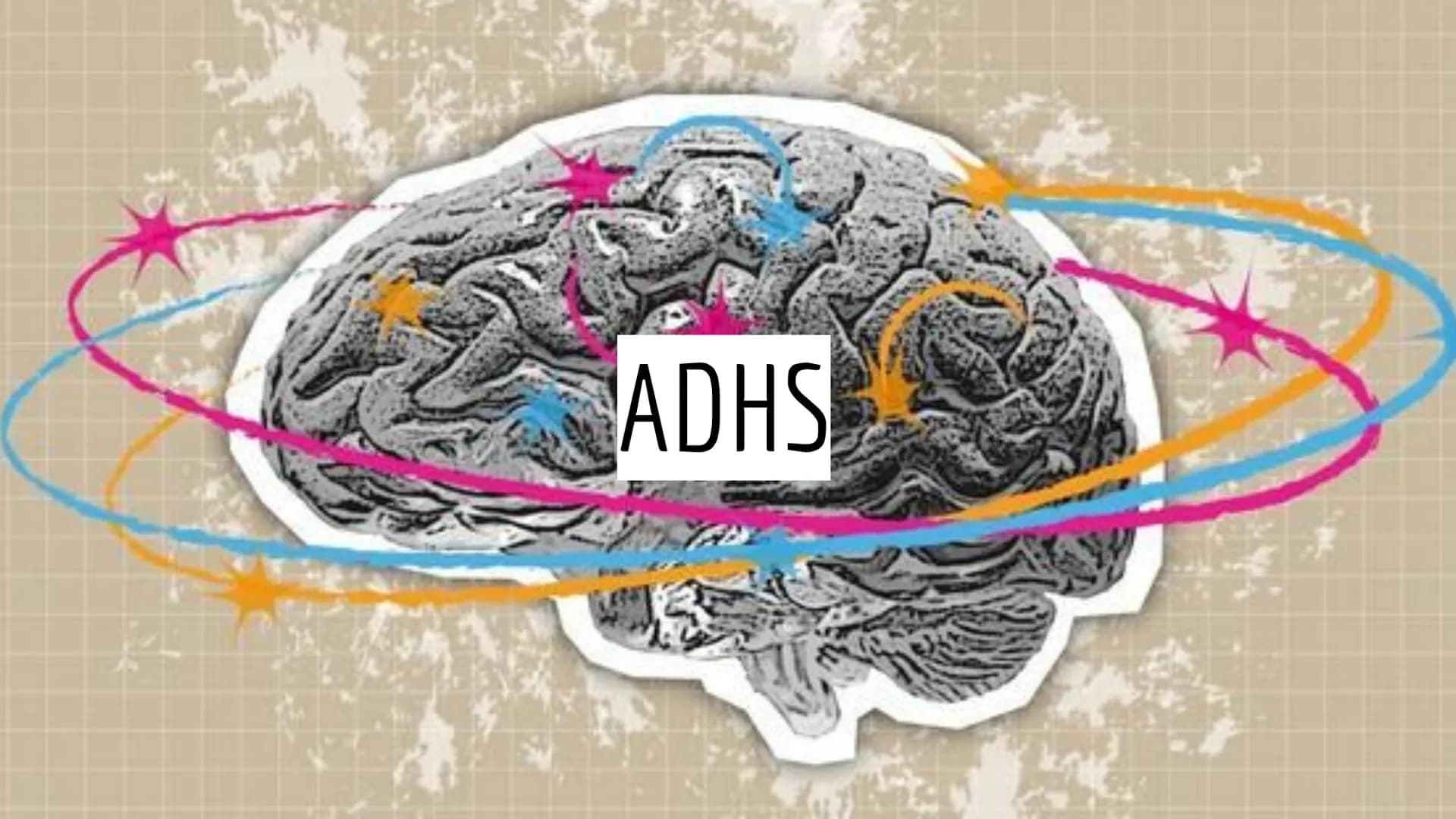 ADHS
3 Gliederung
Definition
• Symptome
Folgen
●
Unterschied ADS - ADHS
Ursachen
Diagnostik
Therapie
Prognose
Quellenangaben
Komorbiditäten 