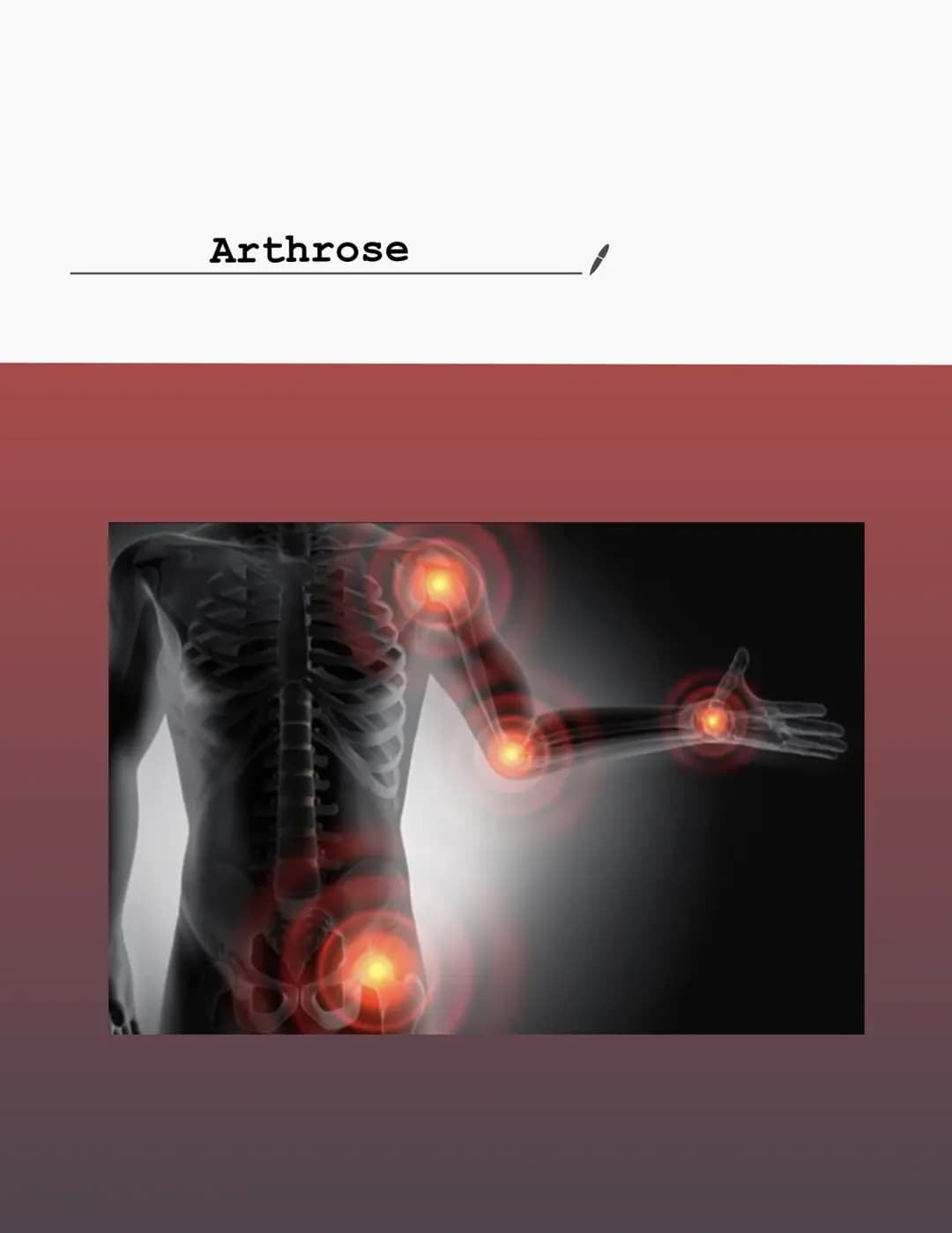 Arthrose Lernzettel