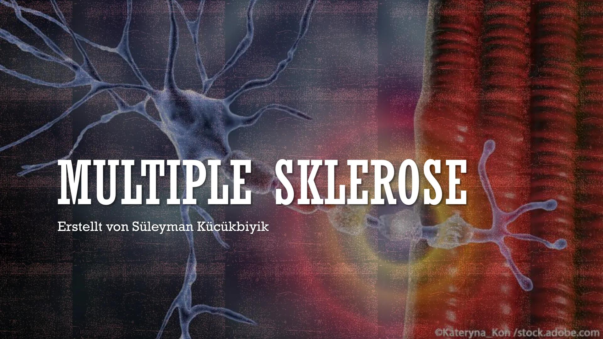 MULTIPLE SKLEROSE
Erstellt von Süleyman Kücükbiyik
Kateryna Kon/stock.adobe.com INHALTSVERZEICHNIS
1. Definition
2. Ursachen
3. MS-Symptome
