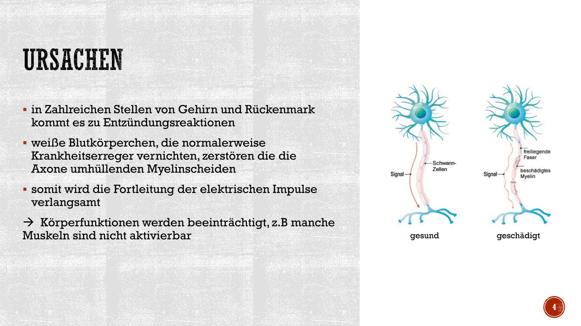 MULTIPLE SKLEROSE
Erstellt von Süleyman Kücükbiyik
Kateryna Kon/stock.adobe.com INHALTSVERZEICHNIS
1. Definition
2. Ursachen
3. MS-Symptome

