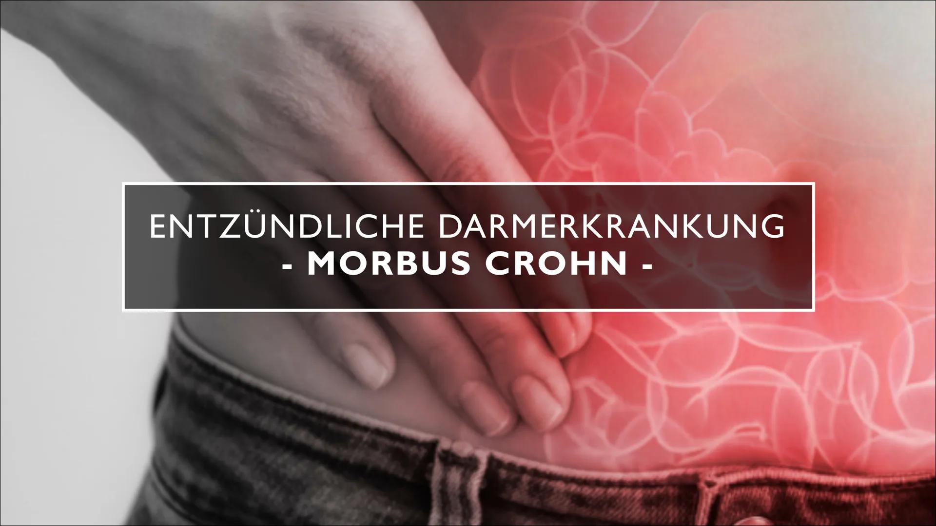 ENTZÜNDLICHE DARMERKRANKUNG
MORBUS CROHN -
em
pee INHALTSVERZEICHNIS
1) Definition
2) Beschreibung der Krankheit
3) Ursachen und Risikofakto