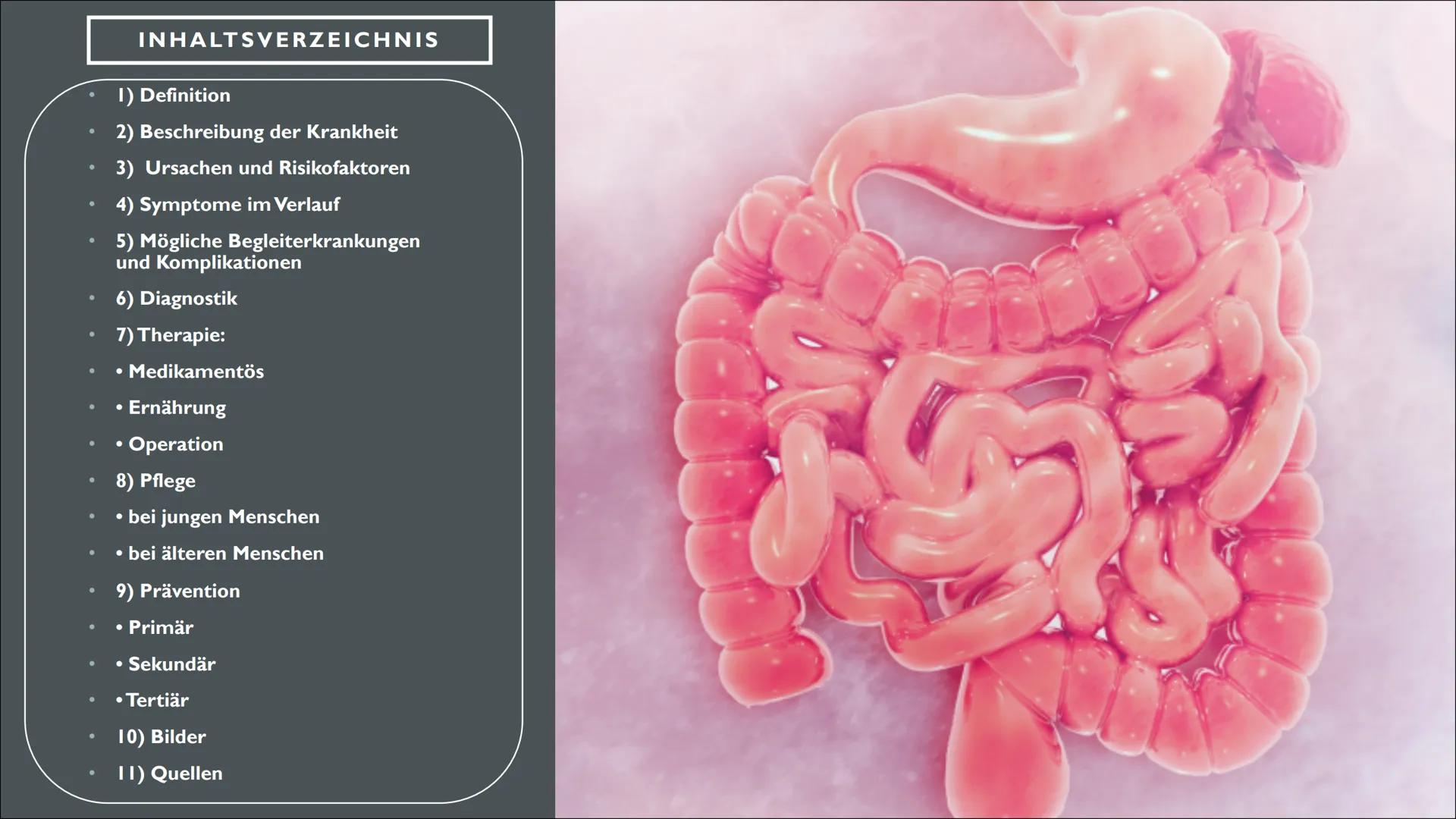 ENTZÜNDLICHE DARMERKRANKUNG
MORBUS CROHN -
em
pee INHALTSVERZEICHNIS
1) Definition
2) Beschreibung der Krankheit
3) Ursachen und Risikofakto
