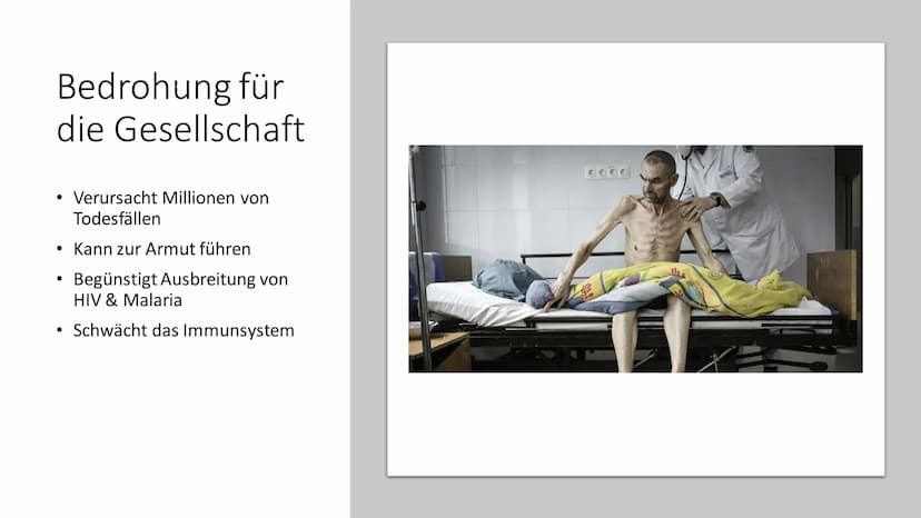 TUBERKULOSE
Eine weltweite Bedrohung Inhalt
●
●
• Symptome Bespiele
●
●
●
●
●
Allgemeine Informationen
Krankheitssymptome & Diagnose
●
Krank