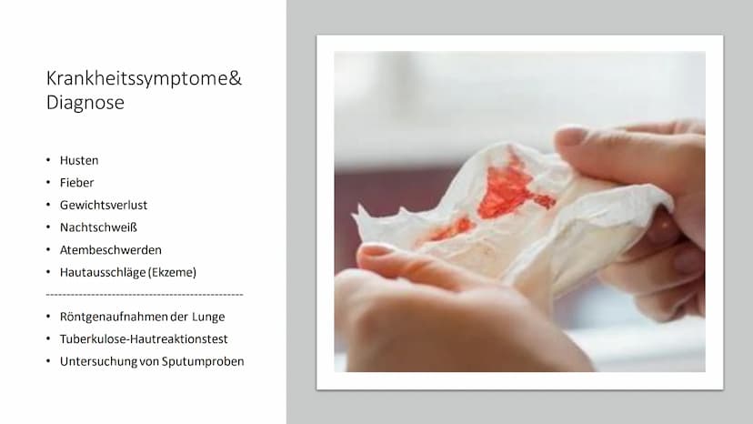 TUBERKULOSE
Eine weltweite Bedrohung Inhalt
●
●
• Symptome Bespiele
●
●
●
●
●
Allgemeine Informationen
Krankheitssymptome & Diagnose
●
Krank