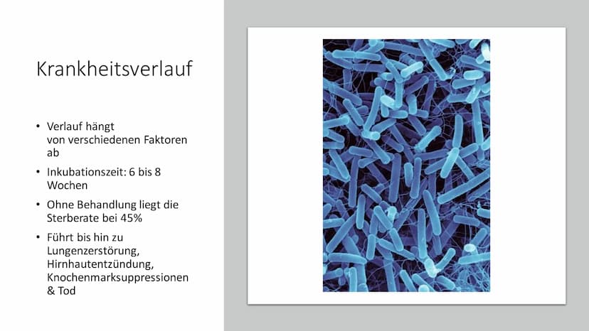 TUBERKULOSE
Eine weltweite Bedrohung Inhalt
●
●
• Symptome Bespiele
●
●
●
●
●
Allgemeine Informationen
Krankheitssymptome & Diagnose
●
Krank
