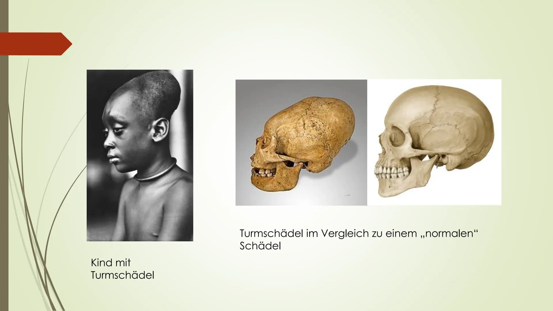 
<p>Die Hunnen, auch bekannt als "Tartaren" oder "Teuflischen", sind ein Nomadenvolk, dessen genaue Herkunft bis heute nicht vollständig gek