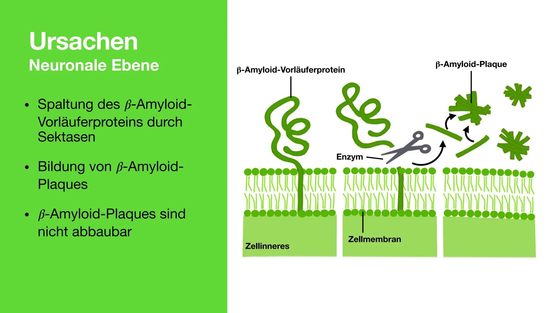Neuronale Erkrankung am
Beispiel Alzheimer
Störung des Hirnstoffwechsels Inhalt
●
• Demenz und Alzheimer
• Symptome von Alzheimer
●
• Neuron
